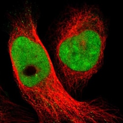 SMCR8 Antibody, Novus Biologicals 0.1mL; Unlabeled:Antibodies, Polyclonal
